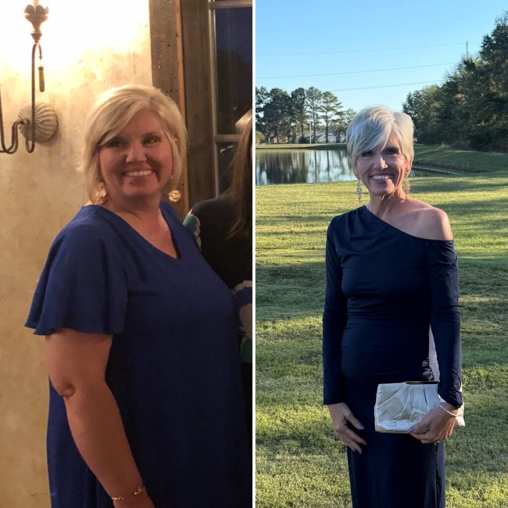 Lori Burt before and after weight loss